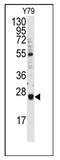 Ubiquitin Conjugating Enzyme E2 E3 antibody, AP12081PU-N, Origene, Western Blot image 