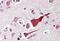 BCL2 Like 10 antibody, MBS240480, MyBioSource, Immunohistochemistry paraffin image 