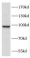 Coatomer Protein Complex Subunit Gamma 2 antibody, FNab01867, FineTest, Western Blot image 