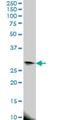 Eukaryotic Translation Initiation Factor 4E Family Member 2 antibody, H00009470-M01, Novus Biologicals, Western Blot image 