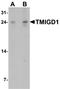 Transmembrane And Immunoglobulin Domain Containing 1 antibody, A16616, Boster Biological Technology, Western Blot image 