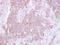 CD81 Molecule antibody, GTX101766, GeneTex, Immunohistochemistry paraffin image 