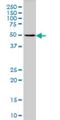 Melanin Concentrating Hormone Receptor 1 antibody, H00002847-M01, Novus Biologicals, Western Blot image 