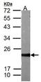 Anti-Silencing Function 1B Histone Chaperone antibody, GTX117936, GeneTex, Western Blot image 