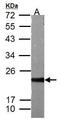 hAsf1b antibody, GTX117936, GeneTex, Western Blot image 