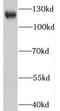 Helicard antibody, FNab04134, FineTest, Western Blot image 