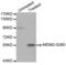 MDM2 Proto-Oncogene antibody, abx000147, Abbexa, Western Blot image 