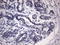 Inhibitor Of Nuclear Factor Kappa B Kinase Subunit Epsilon antibody, LS-C798409, Lifespan Biosciences, Immunohistochemistry paraffin image 