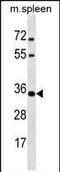 Msh Homeobox 1 antibody, PA5-35227, Invitrogen Antibodies, Western Blot image 