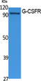 Colony Stimulating Factor 3 Receptor antibody, STJ96434, St John