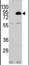 Phosphoinositide-3-Kinase Regulatory Subunit 2 antibody, PA5-15268, Invitrogen Antibodies, Western Blot image 