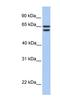 Chromodomain Y Like 2 antibody, NBP1-55178, Novus Biologicals, Western Blot image 
