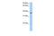 AlkB Homolog 8, TRNA Methyltransferase antibody, GTX47221, GeneTex, Western Blot image 