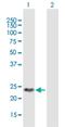 DIRAS Family GTPase 2 antibody, H00054769-B01P, Novus Biologicals, Western Blot image 