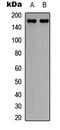 Cytoplasmic Linker Associated Protein 1 antibody, LS-C358454, Lifespan Biosciences, Western Blot image 