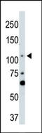 Serine/threonine-protein kinase LATS2 antibody, AP13576PU-N, Origene, Western Blot image 