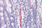 EGF Containing Fibulin Extracellular Matrix Protein 1 antibody, MBS243916, MyBioSource, Immunohistochemistry frozen image 
