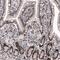 Methyltransferase Like 14 antibody, MA5-24707, Invitrogen Antibodies, Immunohistochemistry frozen image 