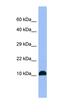 MYCBP Associated And Testis Expressed 1 antibody, orb326424, Biorbyt, Western Blot image 