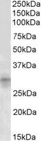 Signal Transducing Adaptor Family Member 2 antibody, 42-457, ProSci, Enzyme Linked Immunosorbent Assay image 