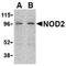 Nucleotide Binding Oligomerization Domain Containing 2 antibody, TA306092, Origene, Western Blot image 