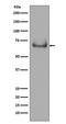Lamin B Receptor antibody, M01238, Boster Biological Technology, Western Blot image 