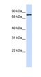 Lymphocyte Transmembrane Adaptor 1 antibody, orb330507, Biorbyt, Western Blot image 