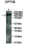 Carnitine Palmitoyltransferase 1B antibody, orb330486, Biorbyt, Western Blot image 