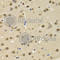 SATB Homeobox 1 antibody, A5800, ABclonal Technology, Immunohistochemistry paraffin image 