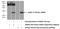 Aralkylamine N-Acetyltransferase antibody, 17990-1-AP, Proteintech Group, Western Blot image 