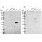 Regucalcin antibody, NBP1-80849, Novus Biologicals, Western Blot image 