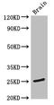 Transmembrane Protein 186 antibody, A61390-100, Epigentek, Western Blot image 