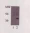 C-Reactive Protein antibody, XG-6175, ProSci, Western Blot image 