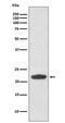 Transforming protein RhoA antibody, M00207-2, Boster Biological Technology, Western Blot image 