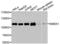 Protein Phosphatase 4 Regulatory Subunit 3A antibody, LS-C410035, Lifespan Biosciences, Western Blot image 
