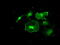 Fyn Related Src Family Tyrosine Kinase antibody, LS-C784347, Lifespan Biosciences, Immunofluorescence image 