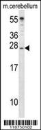 Insulin Like Growth Factor 2 antibody, 55-712, ProSci, Western Blot image 