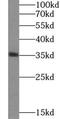 Heme Oxygenase 2 antibody, FNab03938, FineTest, Western Blot image 