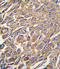 Aldehyde Dehydrogenase 3 Family Member A1 antibody, LS-C97161, Lifespan Biosciences, Immunohistochemistry paraffin image 