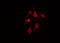 BCL6 Corepressor antibody, GTX01027, GeneTex, Immunocytochemistry image 