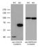 Alpha-Methylacyl-CoA Racemase antibody, LS-C791660, Lifespan Biosciences, Western Blot image 