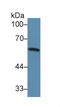 Interferon Regulatory Factor 5 antibody, MBS2028710, MyBioSource, Western Blot image 