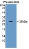 Interleukin 12A antibody, LS-C372433, Lifespan Biosciences, Western Blot image 