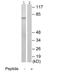 Lysine Acetyltransferase 7 antibody, ab70183, Abcam, Western Blot image 