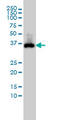 Caudal Type Homeobox 2 antibody, LS-B4299, Lifespan Biosciences, Western Blot image 