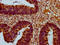 Threonine Synthase Like 2 antibody, LS-C681547, Lifespan Biosciences, Immunohistochemistry paraffin image 