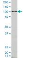 Rho Guanine Nucleotide Exchange Factor 1 antibody, H00009138-M03, Novus Biologicals, Western Blot image 