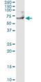 UTP3 Small Subunit Processome Component antibody, H00057050-B01P, Novus Biologicals, Western Blot image 