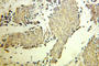 Elongin A antibody, 10502-1-AP, Proteintech Group, Immunohistochemistry paraffin image 