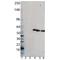 Proteasome 26S Subunit, Non-ATPase 4 antibody, M03544, Boster Biological Technology, Western Blot image 